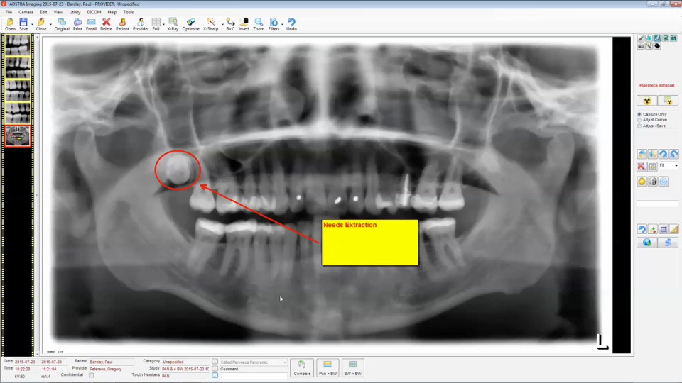 ADSTRA Dental Software Suite - ADSTRA Dental Software Suite-pantalla-2